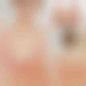 Koronkowy Biustonosz z Zapięciem z Przodu | FRONTBRA